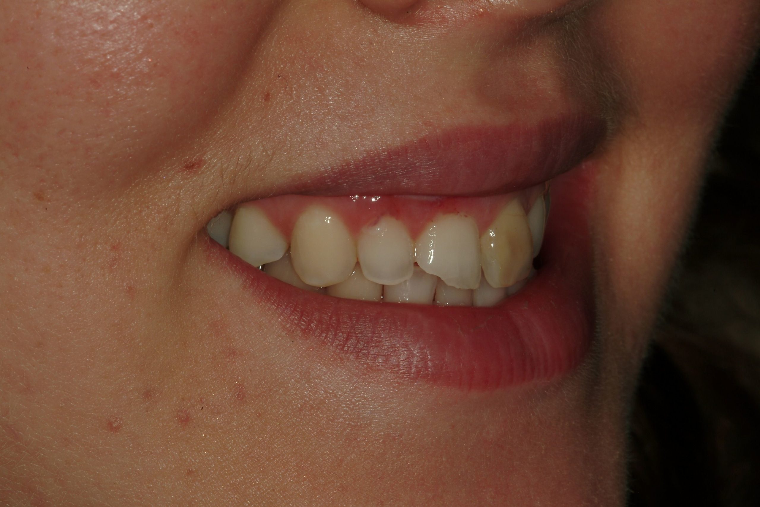 Before Dental treatment