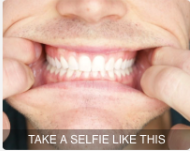 Take a Selfie of your teeth