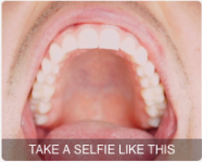 Take a selfie of your mouth