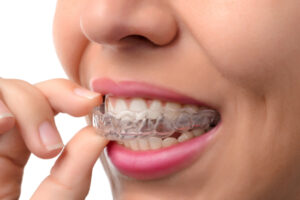 Invisalign is one of the most advanced treatments for teeth straightening
