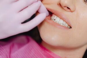 Healthy Habits for Healthy Gums: Preventing Gum Disease with Good Oral Hygiene