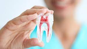 FAQs about Root Canal Therapy