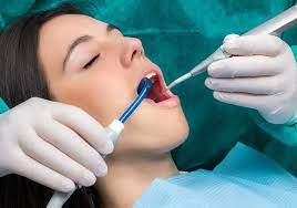 How to Relieve Gum Pain After Dental Cleaning?